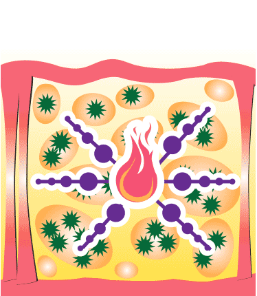 Triglycerides